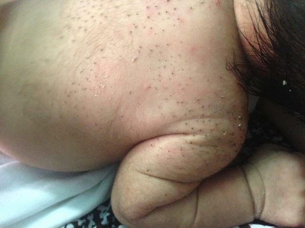 Việc tẩy lông măng cho con là không cần thiết