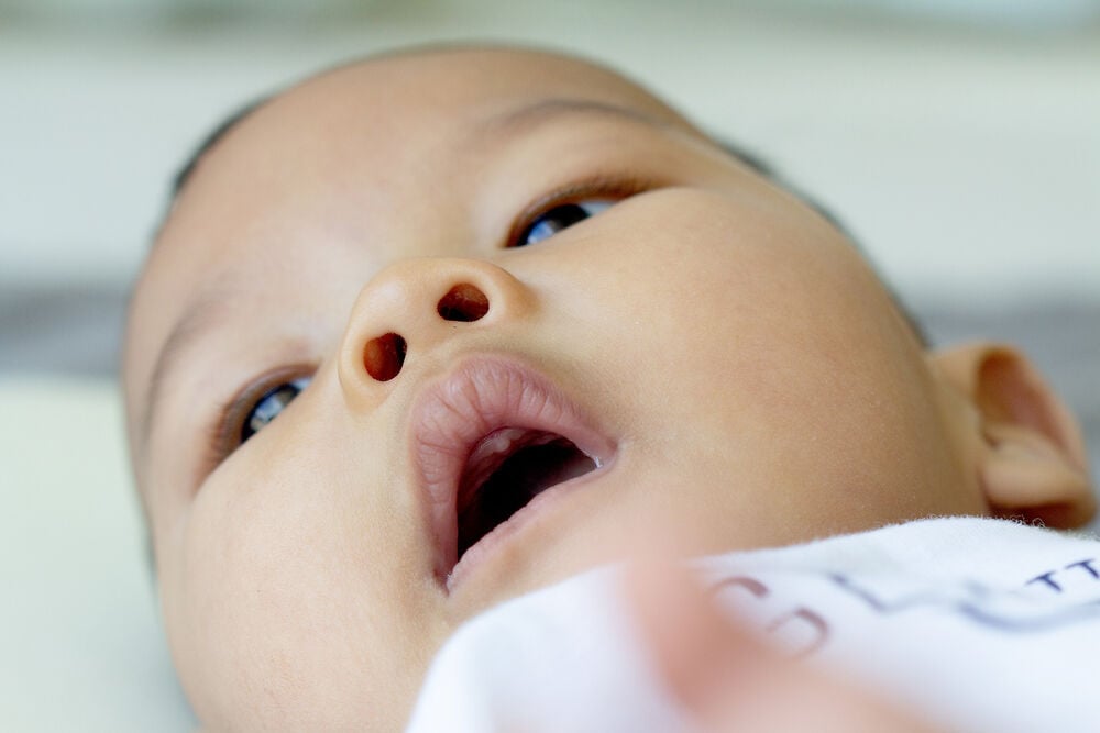 Môi tím tái ở trẻ sơ sinh