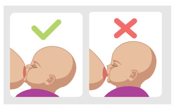 Cho bé ngậm vú chuẩn sẽ giúp mẹ phòng ngừa nứt cổ gà