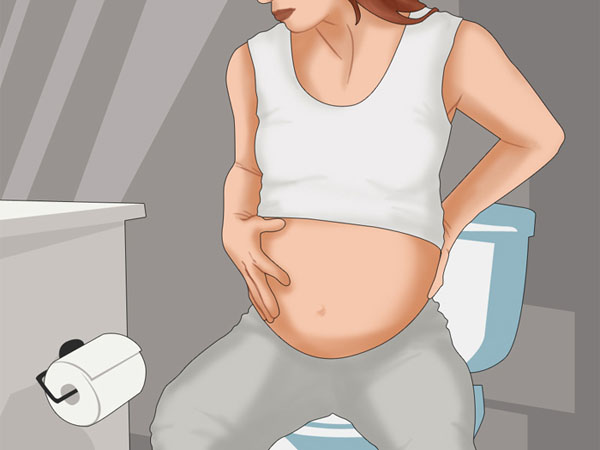 Táo bón khi mang thai là tình trạng đi tiêu phân khô cứng, lâu ngày mới đi một lần