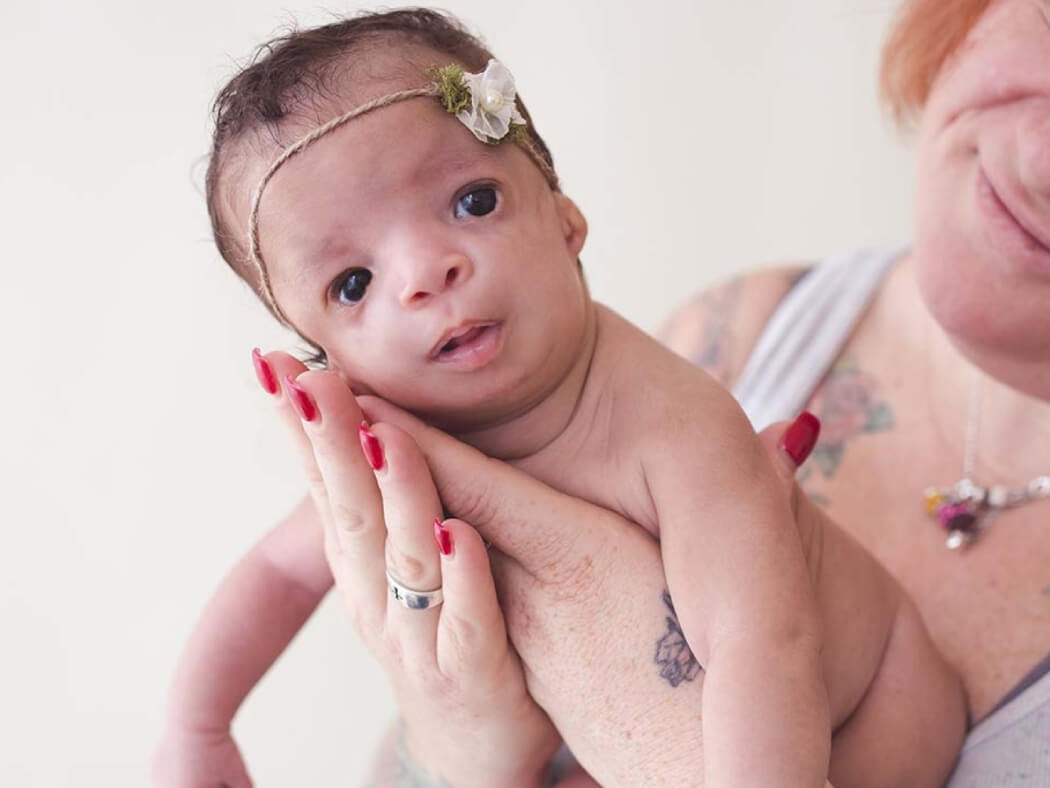 Dị tật thai nhi là sự bất thường về cấu trúc, chức năng cơ thể trẻ