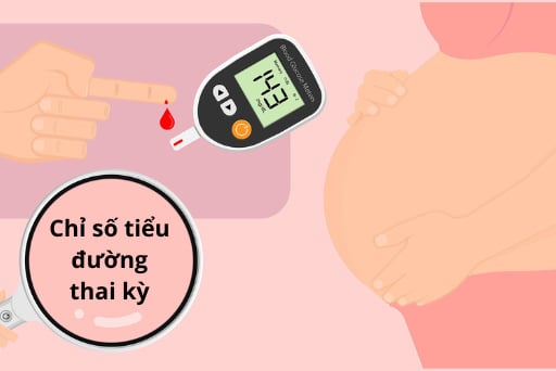 Xét nghiệm tiểu đường thai kỳ được dựa vào nghiệm pháp dung nạp glucose đường uống