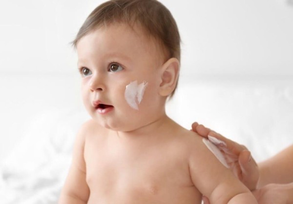 Cách điều trị chàm sữa sơ sinh