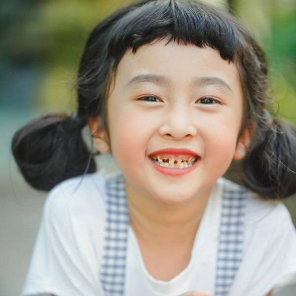 thiểu sản răng ở trẻ