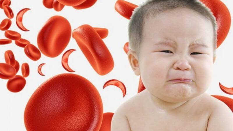 Bé thiếu sắt thiếu máu và mối nguy hại Bé thiếu sắt thiếu máu và mối nguy hại