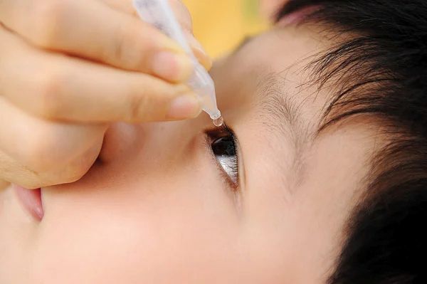 Vệ sinh mắt sạch sẽ với nước muối sinh lý mỗi ngày để phòng tránh đau mắt đỏ