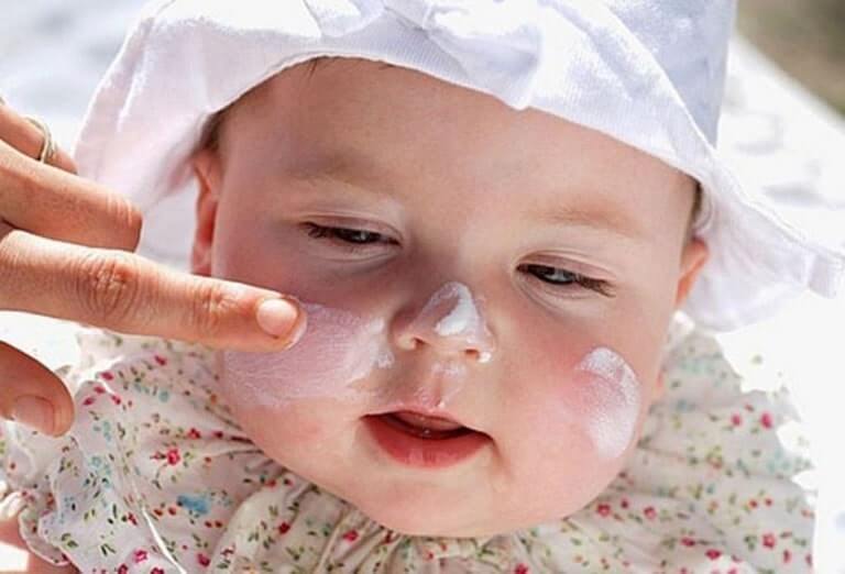Sử dụng Sudocrem trị rôm sảy