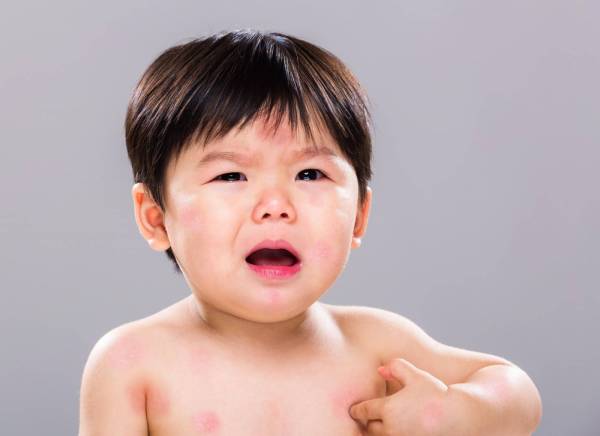 Sữa Hikid dê có thể được sử dụng cho trẻ dị ứng với đạm sữa bò