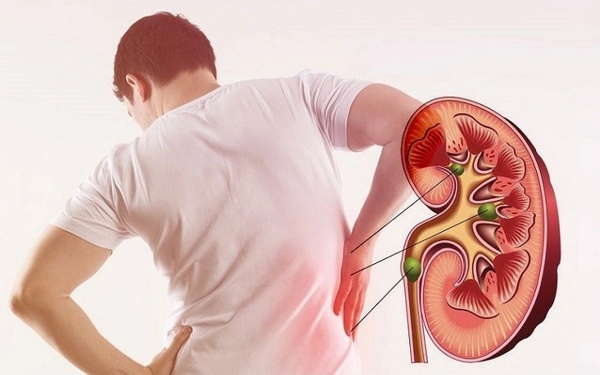 Người bệnh thận cần đặc biệt chú ý khi sử dụng thuốc Tamiflu