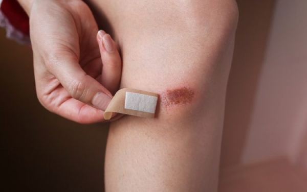 Đường huyết không được kiểm soát khiến vết thương lâu lành