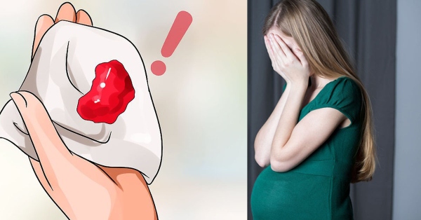 Xuất huyết âm đạo là dấu hiệu động thai đáng lo ngại ở mẹ bầu