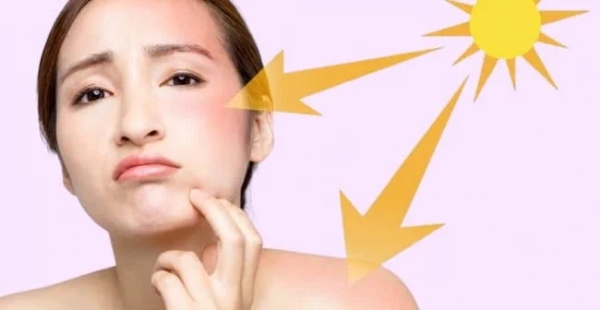 Tia UV có thể khiến da bị tổn thương, sạm đen, lão hóa