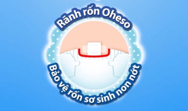 Bỉm có thiết kế rãnh rốn Oheso giúp hạn chế cọ xát vào vùng rốn của bé