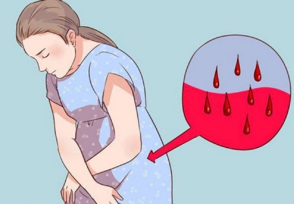 Sản dịch sau sinh có màu đỏ tươi sau đó dần chuyển sang nâu, vàng rồi trắng
