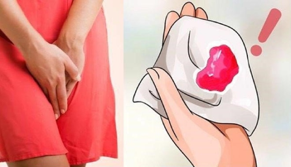 Sau 1 tuần sản dịch vẫn có màu đỏ tươi có thể là dấu hiệu của ứ sản dịch sau sinh