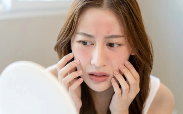 Lựa chọn dưỡng ẩm không phù hợp có thể khiến da kích ứng