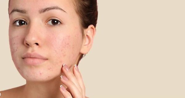 Nên lựa chọn sữa rửa mặt của các thương hiệu uy tín