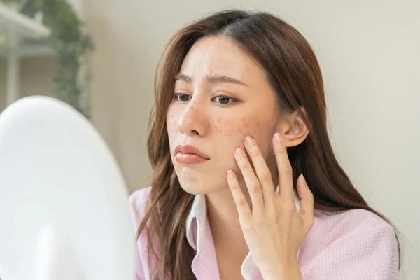 Cần cẩn trọng khi lựa chọn kem dưỡng trắng đối với da nhạy cảm