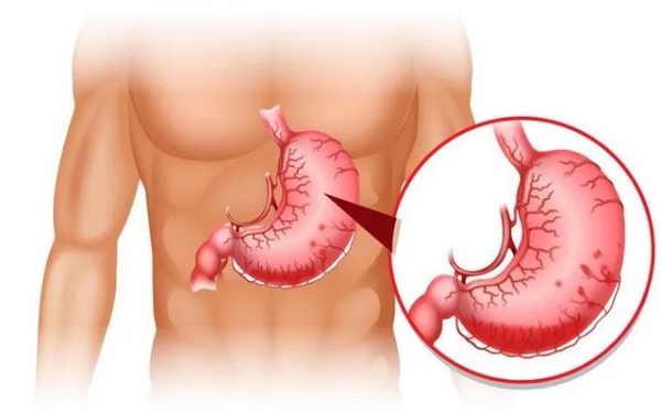Những đối tượng nên và không nên dùng men tiêu hóa