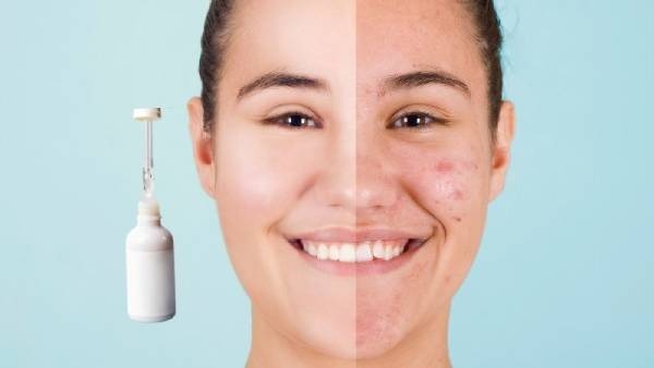 Sử dụng Retinol đúng cách giúp cải thiện làn da đáng kể