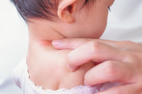 Kem hăm giúp dưỡng ẩm và phục hồi làn da trẻ